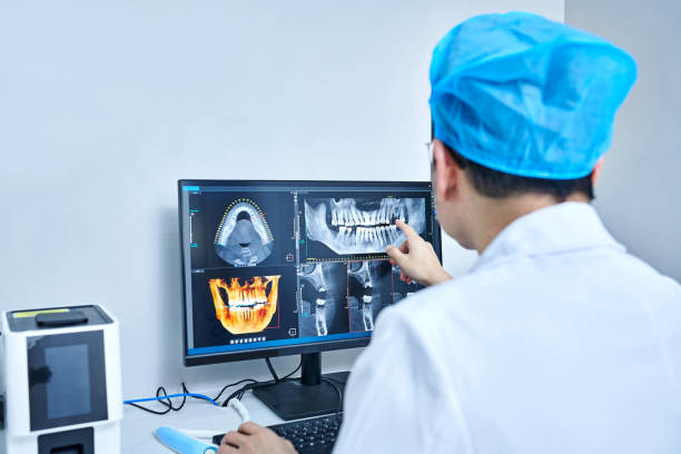 Best Emergency Tooth Extraction in Hughson, CA